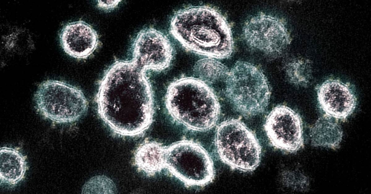 Coronavirus ‘UK variant’ now most common strain in US, CDC reports Coronavirus ‘UK variant’ now most common strain in US, CDC reports