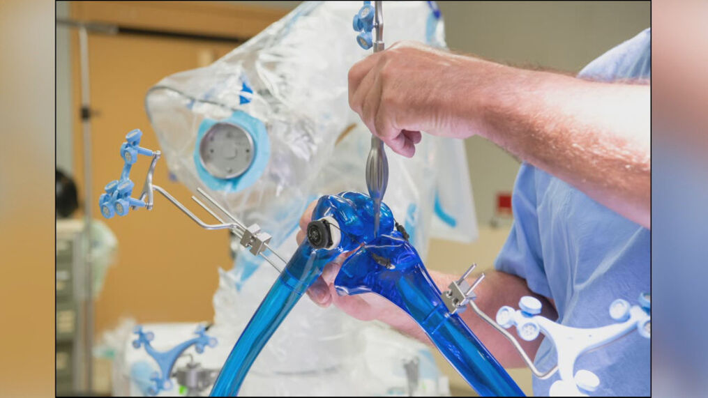 New ‘knee robot’ improving patient surgery outcomes